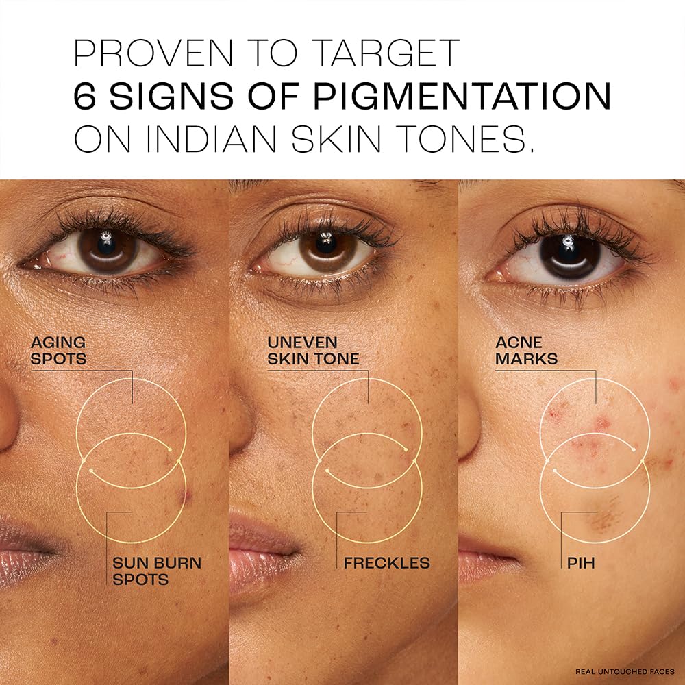 Lakme Perfect Radiance Pigmentation Treatment Day Gel Crème with 10% Niacinamide Resorcinol Complex 7 Antioxidants, 50g [