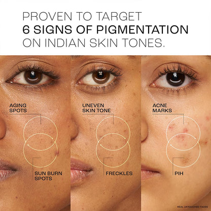 Lakme Perfect Radiance Pigmentation Treatment Day Gel Crème with 10% Niacinamide Resorcinol Complex 7 Antioxidants, 50g [
