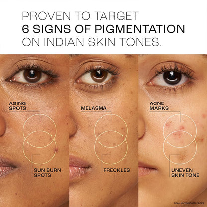 Lakme Perfect Radiance Serum 30 ml